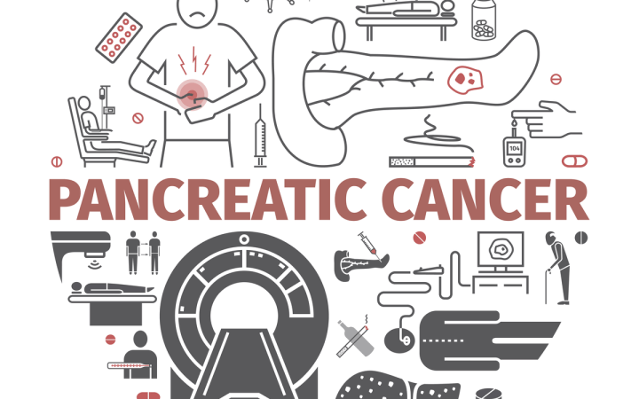 Durerea de pancreas apare inclusiv in fazele avansate de cancer pancreatic