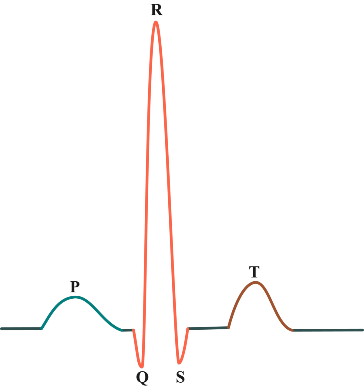 ekg-cand-este-necesar-si-ce-inseamna-un-rezultat-anormal EKG unde normale