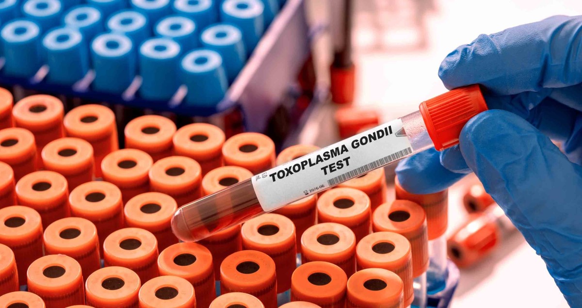 toxoplasma gondii test de sange