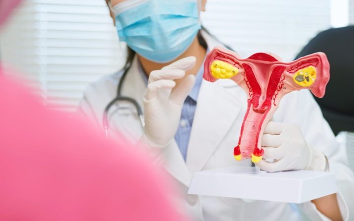 medic îi arată unei paciente un mulaj al organelor de reproducere feminine